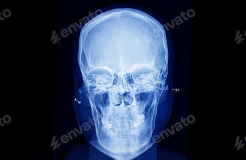Preview: X-Ray film scan of human.
