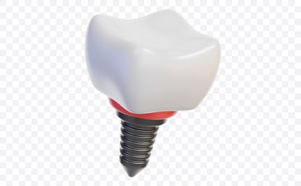 Preview: Dental Implant Tooth
