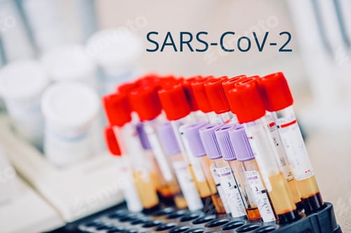 Preview: 2019 2019-ncov adult analysis bacterial banner basic biochemistry biohazard blood bottle brown budge