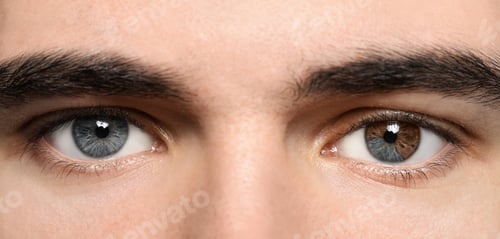 Preview: Man with beautiful eyes of different colors, closeup. Heterochromia iridis