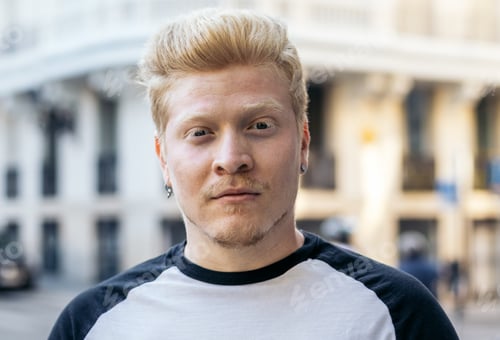 Preview: Close-up of albino latino man in the city street.