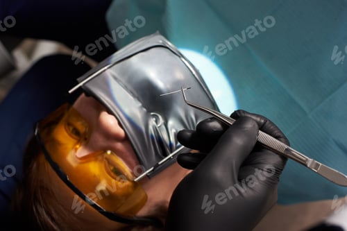 Preview: Dentist in black gloves holds tweezers over a patient using a cofferdam. Close-up.
