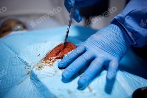 Preview: Surgical Procedure Scalpel Hands, Surgical Care