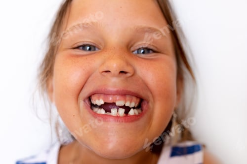 Preview: Toothless smiling, glad, mischievous girl show baby temporary milk teeth on white view. Crooked
