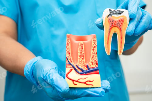 Preview: Asian dentist holding dental implant, artificial tooth roots into jaw, root canal