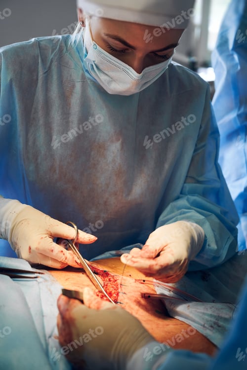 Preview: Female doctor performing abdominoplasty surgery in clinic.