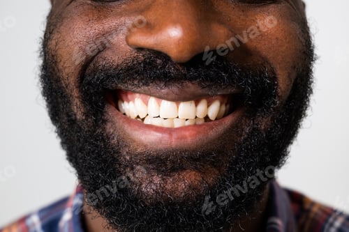 Preview: Teeth close up