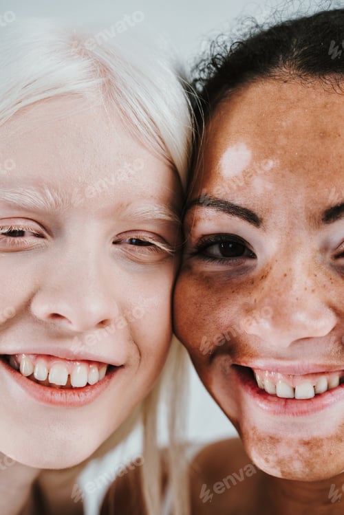 Preview: Couple of multiethnic women