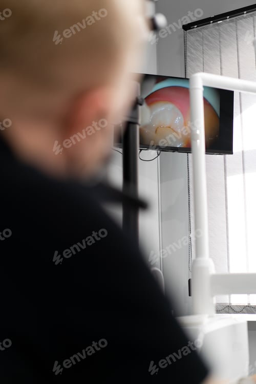 Preview: Dentistry dentist looks at the patient's teeth on the screen