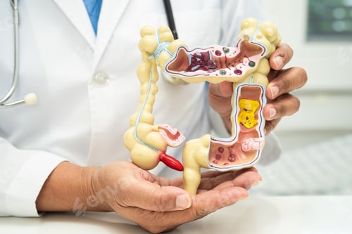 Preview: Intestine, appendix and digestive system, doctor holding anatomy model for study diagnosis