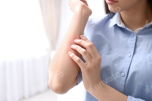 Preview: Young woman scratching hand indoors, closeup with space for text. Allergies symptoms