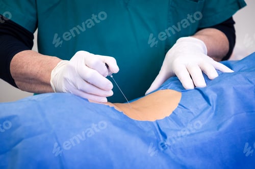 Preview: Infiltration for lumbar hernia
