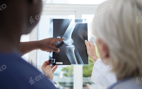 Preview: So many fractures in one bone