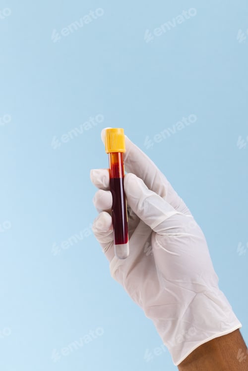 Preview: Hand in white surgical glove holding blood sample tube, on blue background with copy space