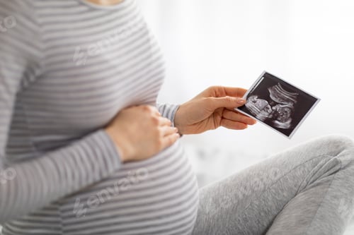 Preview: Pregnant woman holding sonogram of baby, cropped
