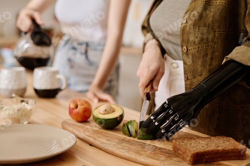 Preview: Girl with prosthetic arm cutting vegetable