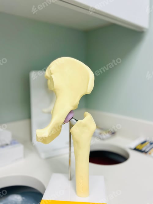 Preview: Ball and socket hip joint.