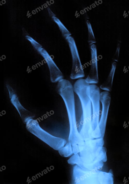 Preview: X-ray hand
