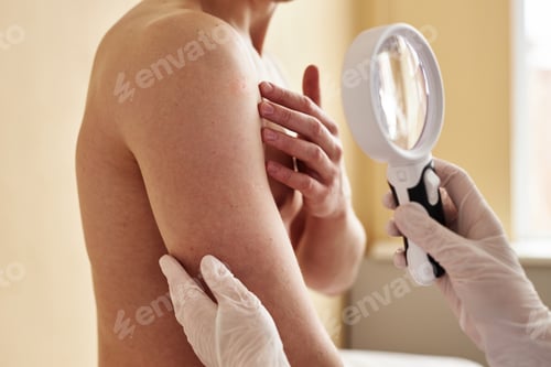 Preview: Close up of doctor using magnifying glass and examining skin of male patient
