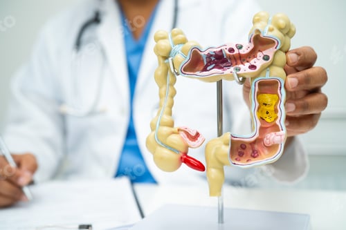 Preview: Intestine, appendix and digestive system, doctor holding anatomy