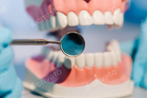 Preview: A dental doctor wearing blue gloves and a mask holds a dental model of the upper and lower jaws and