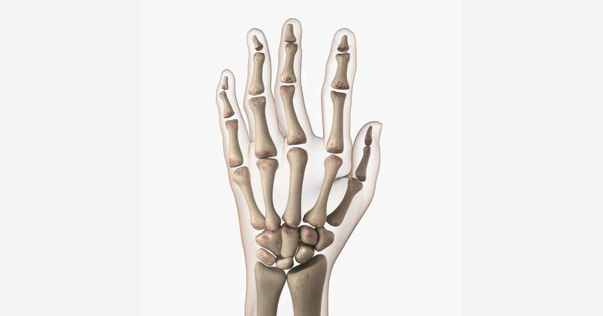 Lateral view of hand bones with partial digit articulation 3D, Incl ...
