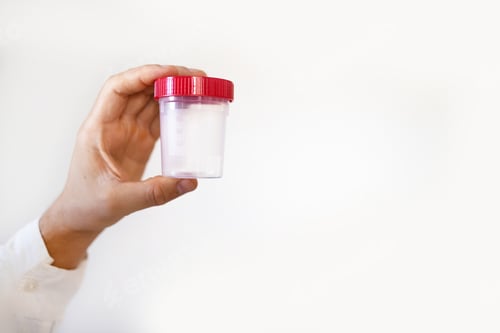 Preview: Drug test. Doctor in white uniform holding a container for semen analysis. Donor sperm for artificia