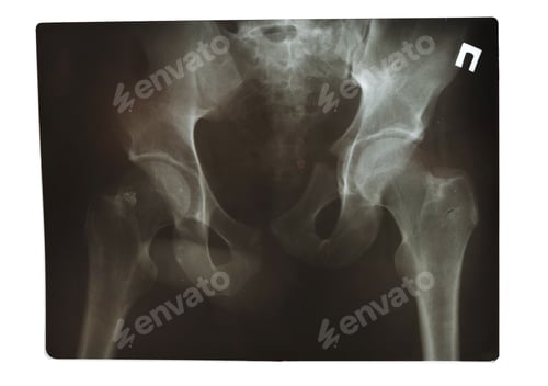 Preview: X-Ray shot