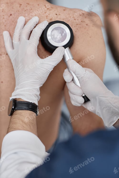 Preview: Caucasian Middle Aged Man Having Back Examined by Dermatologist Using Magnifier