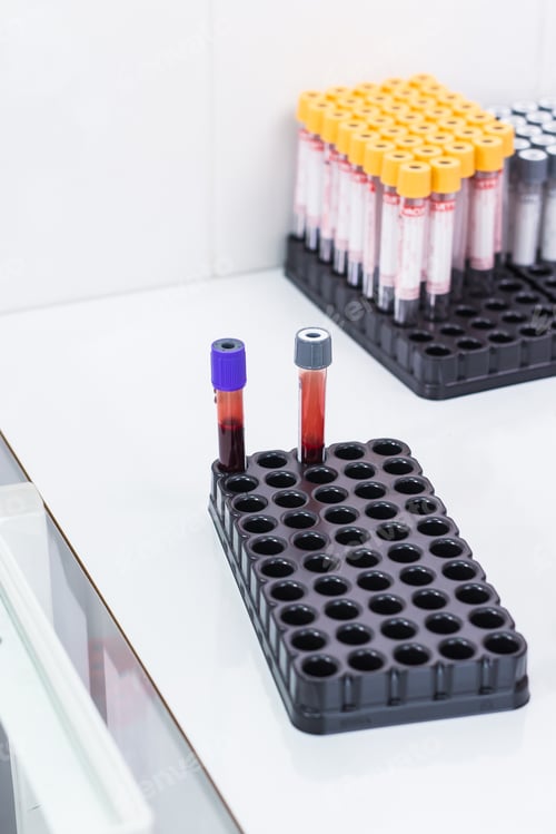 Preview: Covid-19, pandemic and coronavirus concept - blood in tests tubes in laboratory