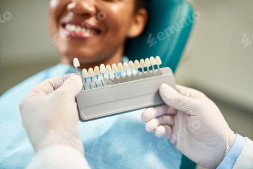 Preview: Close-up of dentist chooses right shade of implants during dental appointment with female patient.