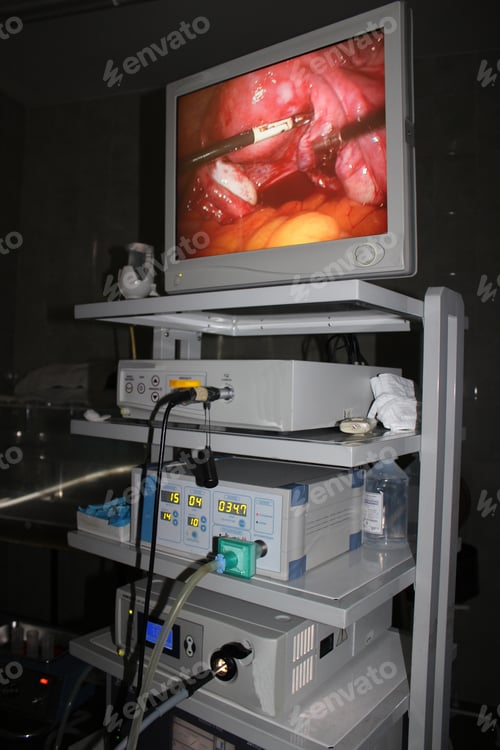 Preview: Medical equipment during endoscopic operations at one of the hospitals