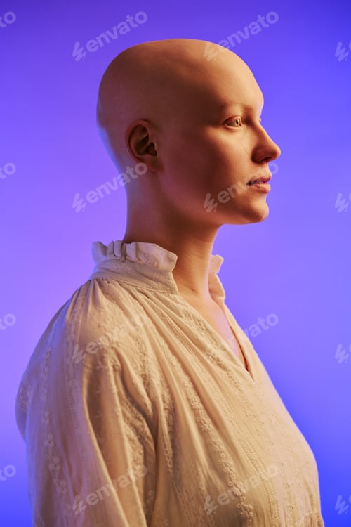 Preview: Young Adult Woman with Alopecia Posing in Profile Against Blue Background