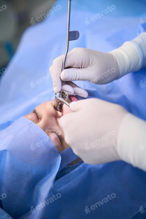 Preview: Doctor performs a polypotomy in a modern clinic