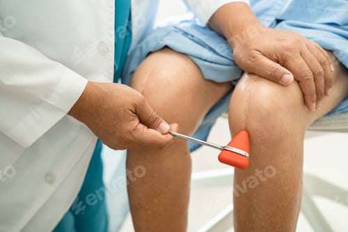Preview: Asian doctor use hammer knock senior woman patient to check knee reflex, nerve and muscle.