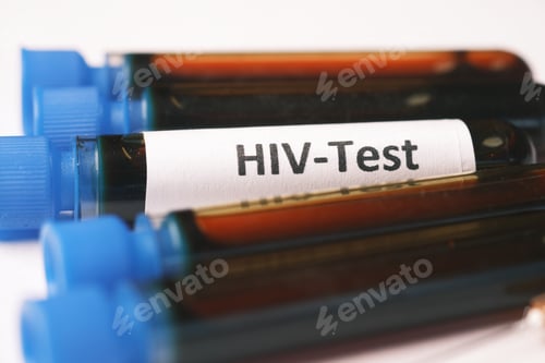 Preview: HIV blood test tube and prescription on table