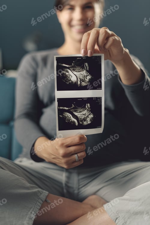 Preview: Happy pregnant woman showing ultrasound images of her baby