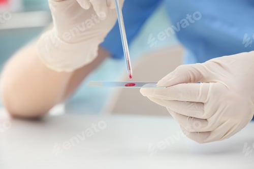 Preview: Scientist dripping blood sample on glass in laboratory