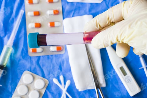 Preview: Hand in gloves holding blood test tube specimen with laboratory equipment background