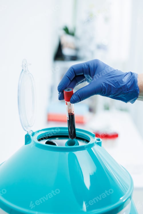 Preview: The blood in the test tube is placed in a centrifuge for plasma therapy. Modern medical equipment.
