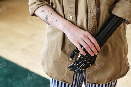 Preview: Young woman with prosthetic arm