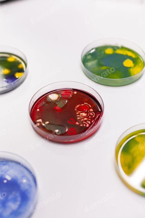 Preview: Close up of petri dish on laboratory desk at clinic
