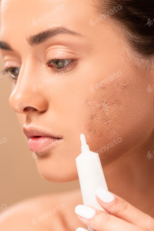 Preview: close up of girl holding treatment cream near face with problem skin isolated on beige