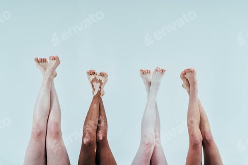 Preview: Group of multiethnic women with different kind of skin posing together in studio