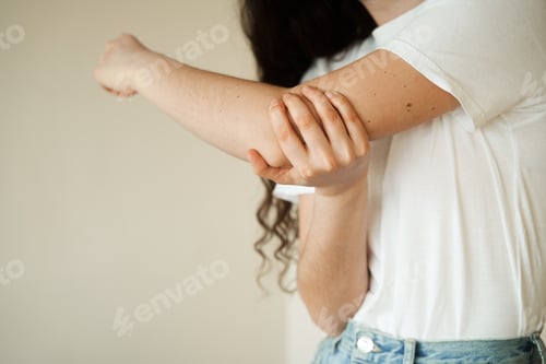 Preview: Elbow trauma. Young woman with arm pain and bruising from accident. Traumatology