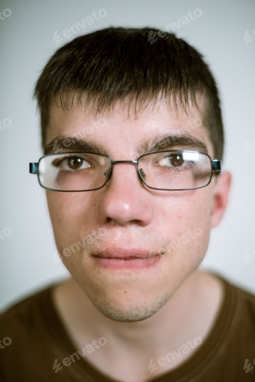 Preview: Portrait of a real young man with a cleft lip on a gray background wearing glasses. Shallow depth of
