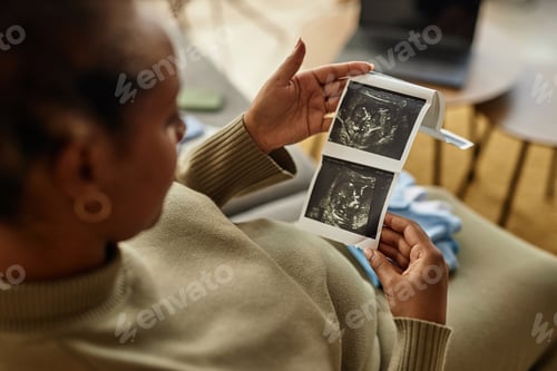 Preview: Ultrasound Images in Hands of Expectant Mother