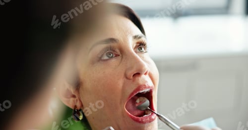 Preview: Mirror, woman patient and dentist for clinic procedure, cleaning examination and treatment. People,
