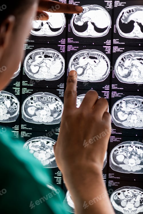 Preview: Doctor reading brain MRI x-ray result