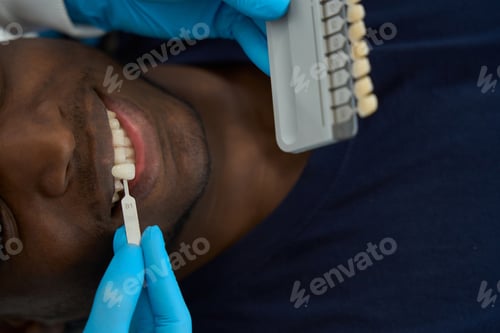Preview: Physician chooses veneers for man in the hospital